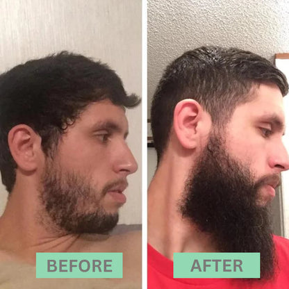 BeardGlow Beard Growth Kit